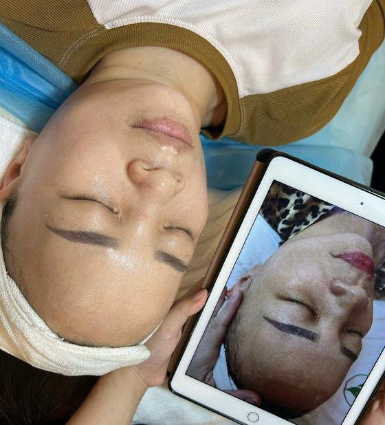 Kết quả khách hàng liệu trình nám