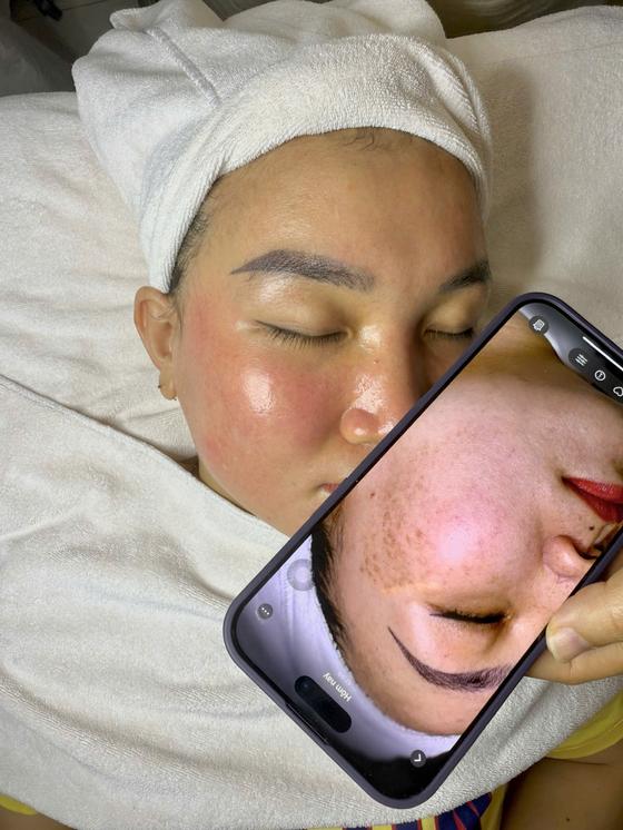 Kết quả khách hàng liệu trình nám
