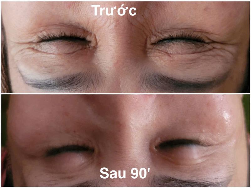 Kết quả khách hàng