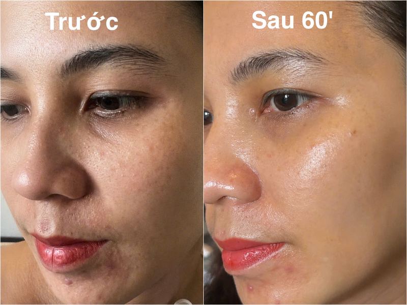 Kết quả khách hàng